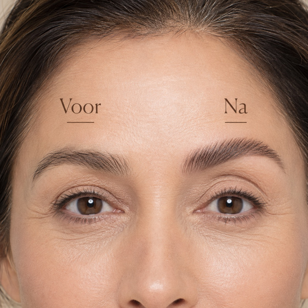 BelleLux Face Frame Set